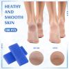 Batiyeer 100 Pcs Pumice Stone for Feet Scrubber Dead Skin Disposable Foot Pumice Foot Shower Scrubber Foot Scrubber for Heel Cuticle Callus Remover Bath Spa (Blue) view 4
