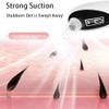 PATINS Blemish & Blackhead Removal Tools, Blackhead Instrument, Heating Blackhead Suction, Electric Beauty Instrument, Hot Compress to Open Pores, Facial Cleansing view 3