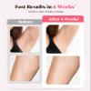 IPL Laser Hair Removal Device for Women & Men - at-Home Painless Hair Remover for Long-Lasting Results, Body & Face for 85% Hair Reduction in 3 Weeks,Pink view 4