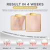 QPTEC IPL Hair Removal Device for Women and Men, Home Use for Face, Legs, Arms, Bikini Line, Whole Body Treatment With 5 Gear Level, Pulsed Light Technology, Unlimited Flashes view 4
