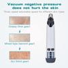 PATINS Acne Comedone Whitehead Extractor Tool - Blackhead Remover Pore Vacuum, Facial Pore Cleaner, Blackhead Suction Tool, Facial Cleansing Pimple Extractor, Electric Acne Extractor Kit view 3