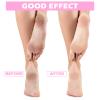 HooLing 3 Pairs Aloe Socks Moisturizing Spa Socks Aloe Vera Infused Fuzzy for Christmas Women Men Repairing Softening Dry Cracked Feet Skins(Pink, White) view 4