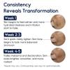 Melasma Treatment for Face - Melasma Cream & Age Spot Remover for Skin Discoloration, Post-Blemish Marks, Scars & Spots | Dark Spot Remover for Face & Body view 2