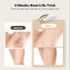 UENMOON Laser Hair Removal for Women and Men - IPL Hair Removal with Ice-Cooling System for Painless & Long-Lasting Result, Whole Body Hair Removal view 2