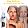 KouRy Portable Blackhead Remover Pore Vacuum, USB Rechargeable,6 Blackhead Extractor Tool,Electric Blackhead Vacuum Cleaner Blackhead ExtractorTool Removal Suction Beauty Device White view 4