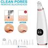 KouRy Black Head Suctioner,Blackhead Remover Vacuum,USB Rechargeable LCD Display,Blackhead Remover Pore Vacuum - Electric Pore Cleaner, Blackhead Extractor Tool for Women and Men Easy to use view 4