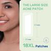 POINTMASS Large Pimple Patches for Face and Body, Hydrocolloid Acne Patches for Big Zit Breakouts and Blemish, Acne Spot Treatment w/Tea Tree Oil for Chin, Nose, Forehead, Body, Back, Neck & Chest view 2