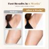 IPL Laser Hair Removal Device for Women & Men - At-Home Permanent Hair Remover for Long-Lasting Results,Body & Face for 85% Hair Reduction in 3 Weeks, Beige view 4