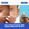 OLIVE YOUNG Care Plus Spot Patch | Hydrocolloid Acne Korean Spot Patch to Cover Zits, Pimples and Blemishes, for Troubled Skin and Face (Hydrocolloid, 15 Count (Pack of 1)) view 3