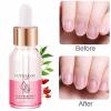 Fujiuia Double Layer Nutrient Oil Anti Barb Dead Skin Moisturizing Care Oil Softener Nail Care 15ml Multi Color Finger Edge view 2