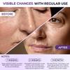 ABERA Belani Retinol Cream for Face, Facial Moisturizer with Collagen Cream and Hyaluronic Acid, Anti-Wrinkle Reduce Fine Lines, Night Anti-Aging For Women (1.01 Fl Oz) (1 Box + 1 Roller) view 3