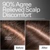 ACT+ ACRE Microbiome Cooling Scalp Serum - Instant Relief for Dry Itchy Scalp & Loose Flakes - Peppermint Oil & Amino Acid for Scalp Balance - Natural, Vegan, Paraben-Free Formula - 2.2 fl oz view 3
