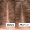 ACT+ ACRE Microbiome Cooling Scalp Serum - Instant Relief for Dry Itchy Scalp & Loose Flakes - Peppermint Oil & Amino Acid for Scalp Balance - Natural, Vegan, Paraben-Free Formula - 2.2 fl oz view 4
