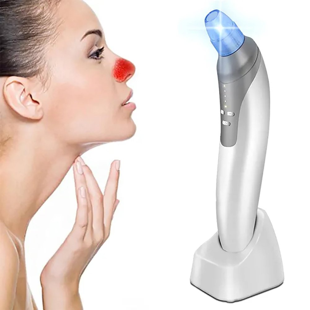 Blackhead Instrument, Rechargeable Blackhead Extractor, Blackhead Removal Therapy, 4 Suction Heads/4 Adjustment Modes/USB Charge, Ideal for Exfoliating,Massaging and Deep Pore Cleansing