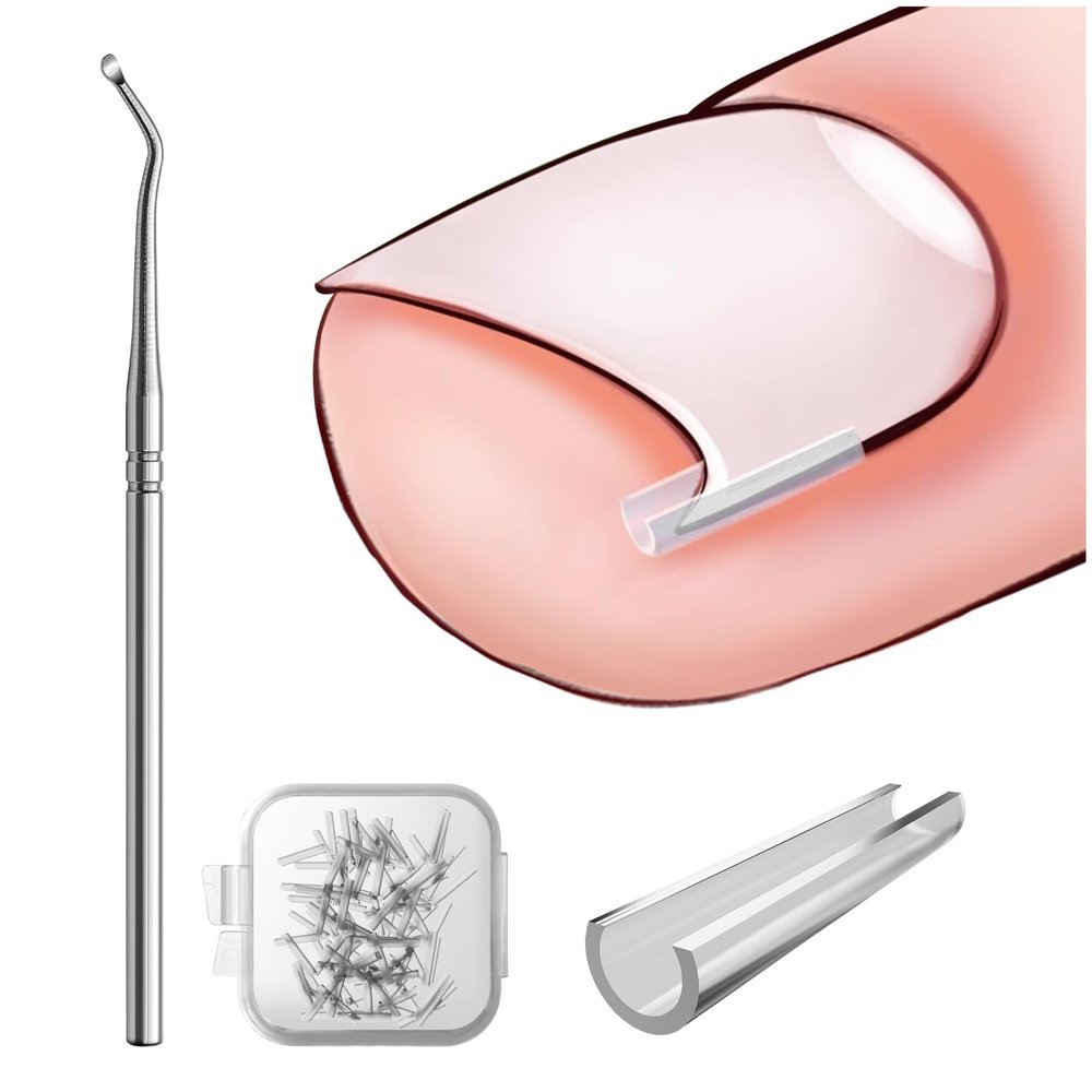 BEZOX Ingrown Toenail Corrector Set - 40 Pcs Pain-Free Toenails Straightener Strips with Toe Nail Lifter - Easy Use Ingrown Toenail Tools Kit