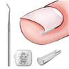 BEZOX Ingrown Toenail Corrector Set - 40 Pcs Pain-Free Toenails Straightener Strips with Toe Nail Lifter - Easy Use Ingrown Toenail Tools Kit view 1
