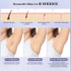DABZAL Laser Hair Removal for Women and Men Permanent, IPL Hair Removal Device, Upgraded 999,999 Flashes,At Home Painless Hair Removal for Facial Armpits Legs Bikini Line Whole Body, Corded view 2