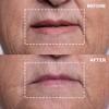 Wrinkles Schminkles Eye & Mouth Lift Set | Mouth & Lip Wrinkle Patch 2-Pack & Eye Wrinkle Patches 3-Pairs | Reusable Medical Grade Silicone Patches view 3