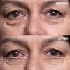 Wrinkles Schminkles Eye & Mouth Lift Set | Mouth & Lip Wrinkle Patch 2-Pack & Eye Wrinkle Patches 3-Pairs | Reusable Medical Grade Silicone Patches view 4