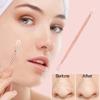 1 Professional Stainless Steel Blackhead Remover Blemish Extractor Tool  Acne Skin Nose Face Tzone Whitehead Zit Pimple Popper Comedone Pustule Removal Double Ended 2 in 1 Nonslip view 2