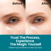 Nurive's Timeless Beauty Wrinkle-Care Duo Pack | Helps Minimize Forehead Lines, Frown Lines, Under Eye Bags, Dark Circles view 3