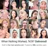 NDP Microbiome Ampoule Serum | Bebebiome Postbiotics for Antiaging, Youth Activating, Beta-Carotene, Wrinkle Care, Korean Skincare (30ml / 1.01 Fl oz) view 2