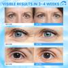 RONKIE Caffeine Eye Cream for Dark Circles: Caffeine Eye Stick - Smooth Fine Lines and Hydrate Eye Area view 3