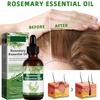 Aceite de Romero para Crecimiento y Tratamiento Capilar, Gotero para Estimular el Crecimiento del Cabello y Prevenir la Cada, 60ML/2.2 Fl Oz (2 Unidades) view 3