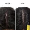 shu uemura art of hair Essence Absolue Pre-Shampoo & Nourishing Treatment Oil - Soothes Dry and Flaky Scalp, Leaves Scalp Moisturized and Balanced, Nourishes For Soft and Shiny Hair, 1.7 Fl Oz view 2