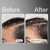Act+Acre Cold Processed Stem Cell Scalp Serum - Promotes Thicker and Fuller-Looking Hair - Soothes and Hydrates the Scalp - Sulphate and Paraben Free - Aloe Vera for Improved Scalp Health - 1 fl oz. view 2