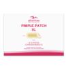 Albatross Health New England Large Acne Pimple Patches for Face (20 Counts), Spot Dots Cover, Hydrocolloid Stickers, Zit Blemish Patch view 1