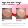 ANUA Niacinamide 10 + TXA 4 Serum, Hyaluronic Acid, Tranexamic acid, Facial Serum For GlassSkin, Glow Back Serum, Dark Spot Care, Postnatal Skincare, Korean Skincare (30ml/1.01 fl.oz) view 4