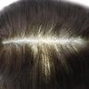 Mens Toupee Hair System For Men 0.06mm Super Thin Skin V-looped Mens Hair Replacement System Natural Hairline Toupee For Men Poly Skin8"X10"#2 Darkest Brown-100% Light To Medium density view 4