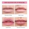 Lip Care Gel Lip Moisturizing Absorption Of Gel Moisturizing Lip | Nourishing And Hydrating Dry Lips Oil Butter Organic Based Balm 10ml Wet And Wild Lip Gloss (B, One Size) view 3