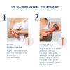 FOREO PEACH 2 IPL Hair Removal Device + Calming & Hydrating IPL PEACH Cooling Prep Gel - Permanent Hair Removal - Laser Hair Removal For Body & Face - Hair Removal with Skin Cooling & Silicone Shield view 2