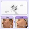Magnesium Blemish Microdarts | Pimple Patch | Fast-Acting | Quick Calming | 99.9% Pure Magnesium | Madecassic Acid | Tea Tree | Eucalyptus Leaf | Hydrocolloid Spot Care Patch view 3