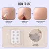 Magnesium Blemish Microdarts | Pimple Patch | Fast-Acting | Quick Calming | 99.9% Pure Magnesium | Madecassic Acid | Tea Tree | Eucalyptus Leaf | Hydrocolloid Spot Care Patch view 4