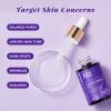 ANAI RUI Niacinamide Serum 10% with Arbutin,Zinc 1% &Vitamin B3 for Face, Minimizer Pores, Redness Relief,Reduce Uneven Skin Tone,Wrinkles&Fine Lines,1fl.oz view 4