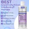 Anti Fungal Shampoo for Men & Women | Anti Dandruff, Medicated, Folliculitis Shampoo for Dry Scalp, Psoriasis, Ringworm | for Itchy, Flaky & Irritated Scalp | No Paraben & Sulphate view 3