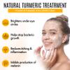 Healov Turmeric Skincare Set - Turmeric Skin Care Products Brightening & Acne - Turmeric Skin Care Kit, Turmeric Skin Care Set - Turmeric Cleanser, Body Scrub, Face Cream & Facial Serum view 3