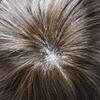 Full French Lace Mens Toupee Human Hair Replacement System Soft Lace Bleached Knots Natural Hairpieces for Men 8"X10" #3 Dark Brown-90% density view 4