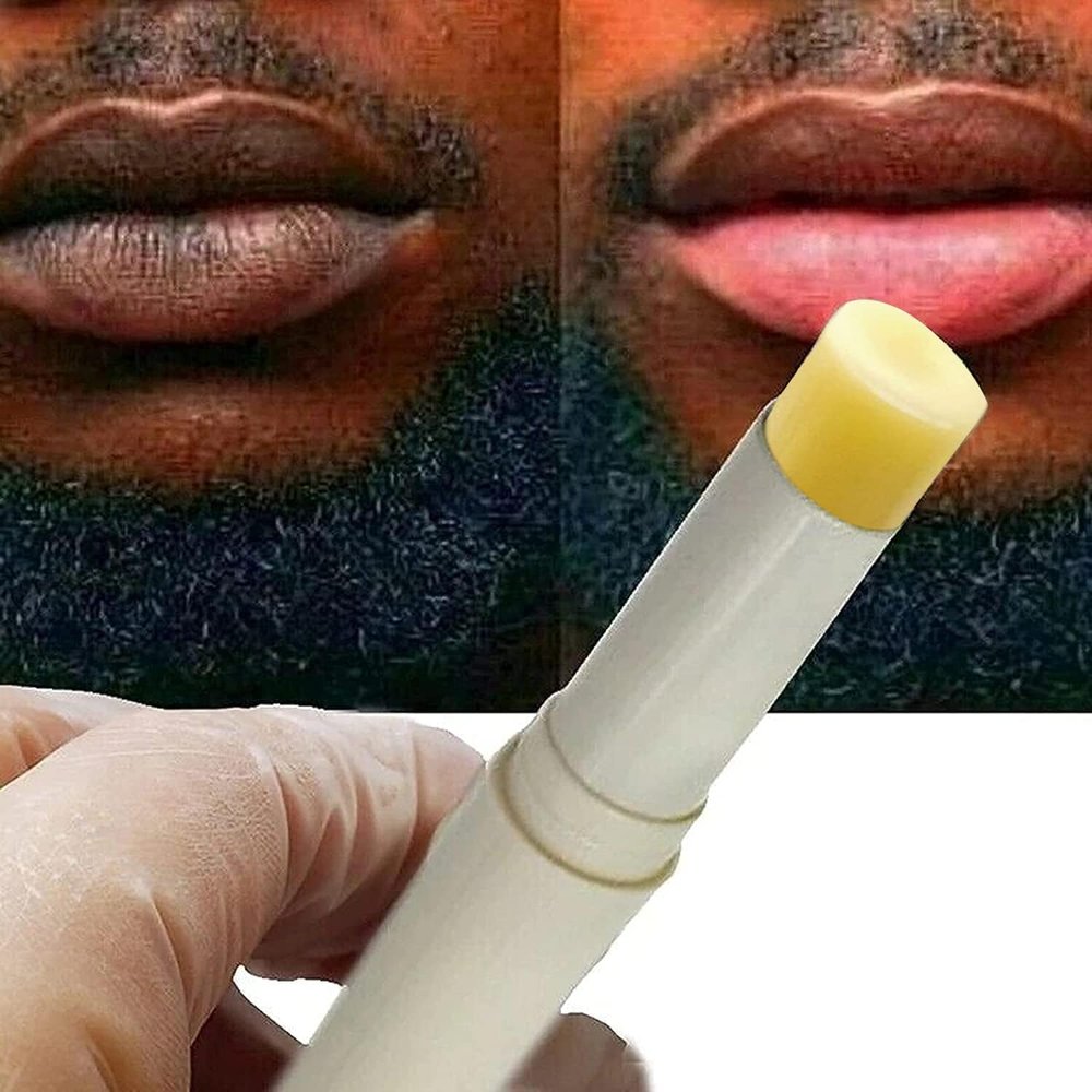 2pcs Lip for Dark Lips Lip for Smokers Dark Lip Treatment Cream for Pink Lips Lip for Smoker Lips Lip balm for Men and Women (Yellow)