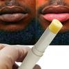 2pcs Lip for Dark Lips Lip for Smokers Dark Lip Treatment Cream for Pink Lips Lip for Smoker Lips Lip balm for Men and Women (Yellow) view 1