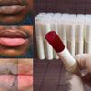 2pcs Lip Lightening for Dark Lips Lip for Smokers Dark Lip Treatment Lightening Cream for Pink Lips Lip Lightener for Smoker Lips Lip Lightening balm for Men and Women (Red) view 1