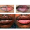 2pcs Lip Lightening for Dark Lips Lip for Smokers Dark Lip Treatment Lightening Cream for Pink Lips Lip Lightener for Smoker Lips Lip Lightening balm for Men and Women (Red) view 4