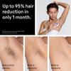 Braun Smart IPL, Vogues Best Hair Removal Device, Skin iExpert Pro 7: at Home Laser Hair Removal, Permanent Visible Hair Reduction, Free App, Venus Razor, 2 Smart Head, Facial Trimmer, IPL7219 view 3