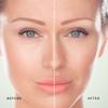 Xtreme Lashes Total Eye Rejuvenation Kit view 3