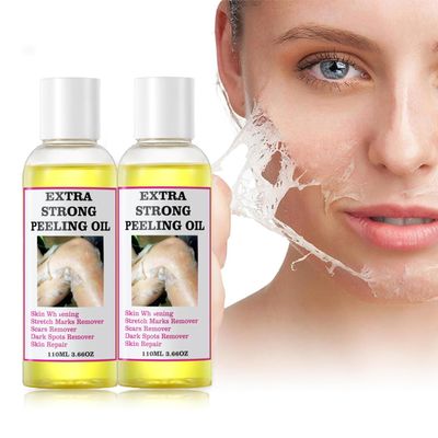 Strong Peeling Oil Extra Strength, Peeling Oil for Dark Skin, Yellow Peeling Oil, Exfoliating Peeling Solution for Body All Skin Type Dead Skin Remover 220ML