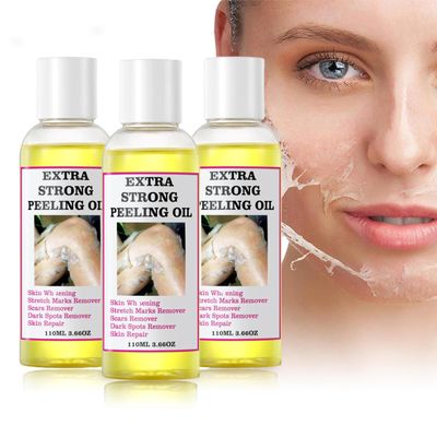 Strong Peeling Oil Extra Strength, Peeling Oil for Dark Skin, Yellow Peeling Oil, Exfoliating Peeling Solution for Body All Skin Type Dead Skin Remover 330ML