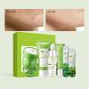 Green Tea Skincare Set, 19-In-1 Skincare Gift Set, With Natural Extracts,Cleanser,Face Serum, Face Cream, Eye Cream, Facial Mask And Mud Mask,Moisturizing Skincare Set For Teen Girls view 4